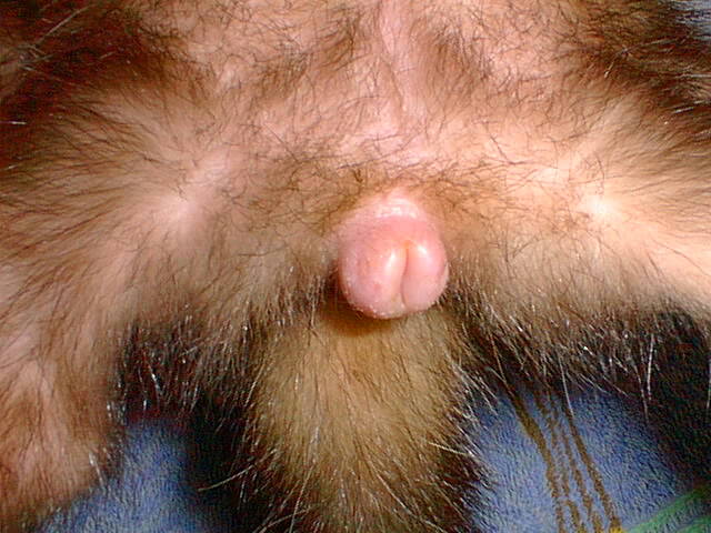 副腎腫瘍
