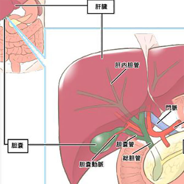 胆嚢