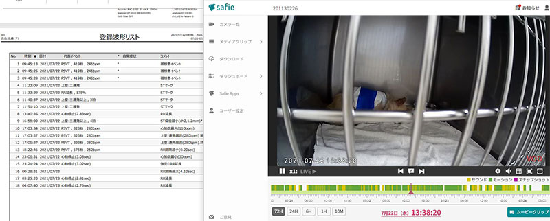 動画とホルターを同期させての検査