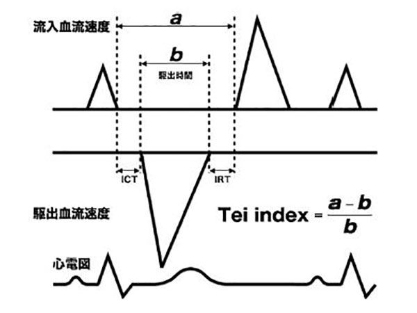 TEI-index